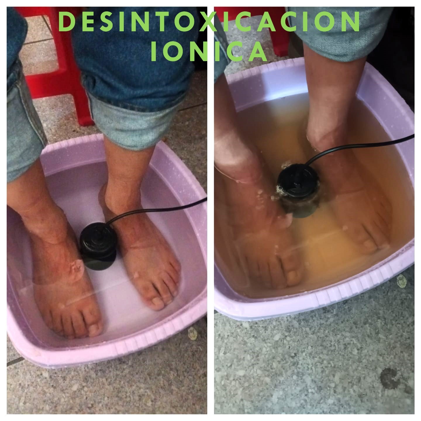 Desintoxicación Iónica