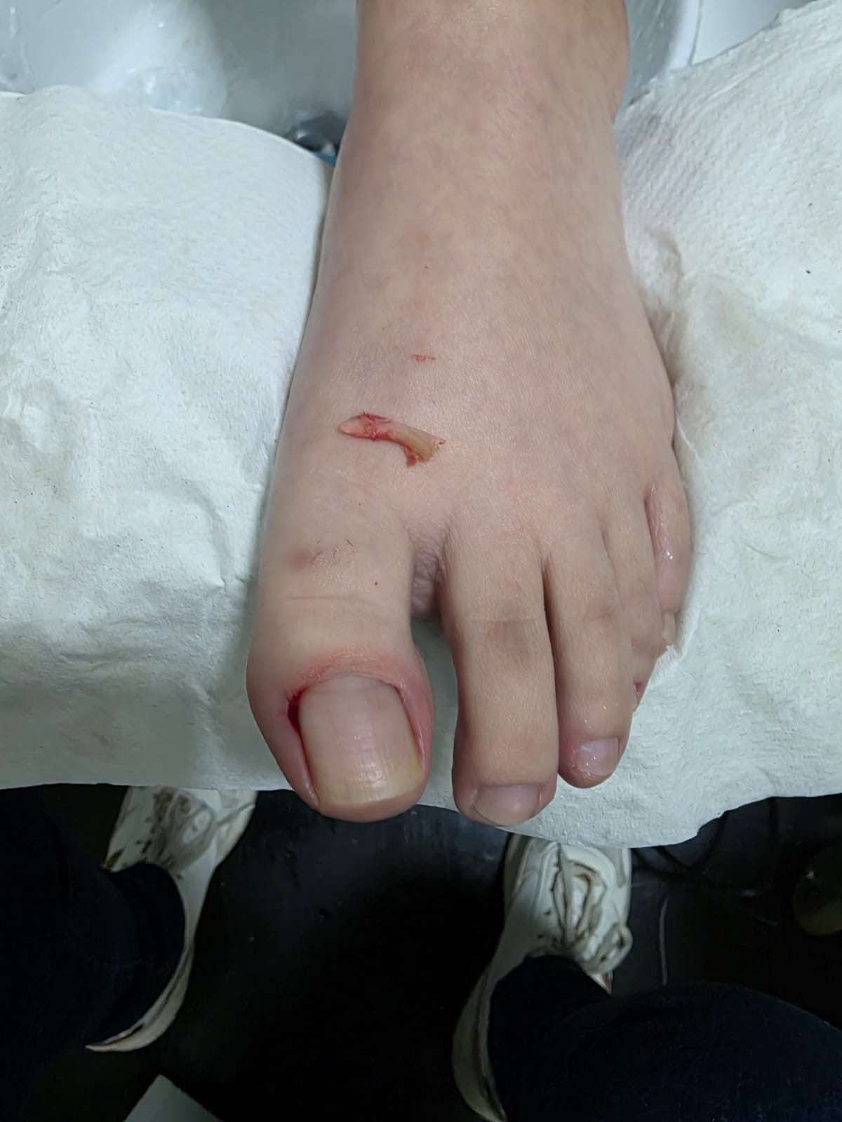 Pedicura Clínica